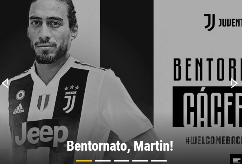 技惊四座，麦克托米奈开场3分钟为苏格兰打入一粒精彩的倒钩（开场仅3分钟，麦克托米奈倒钩破门惊艳全场）